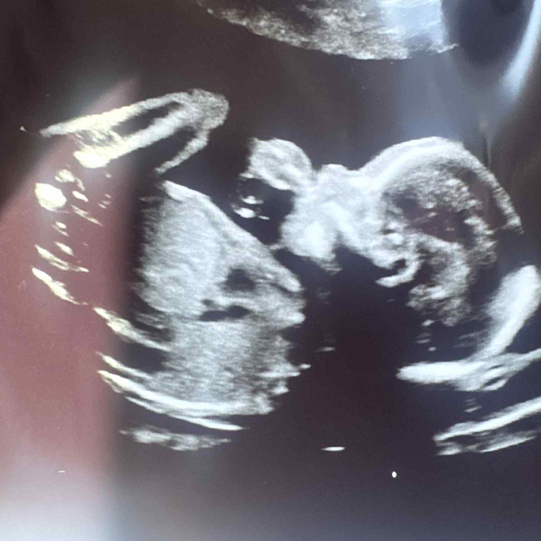 Photo shared by Celina for their Babylist baby registry.