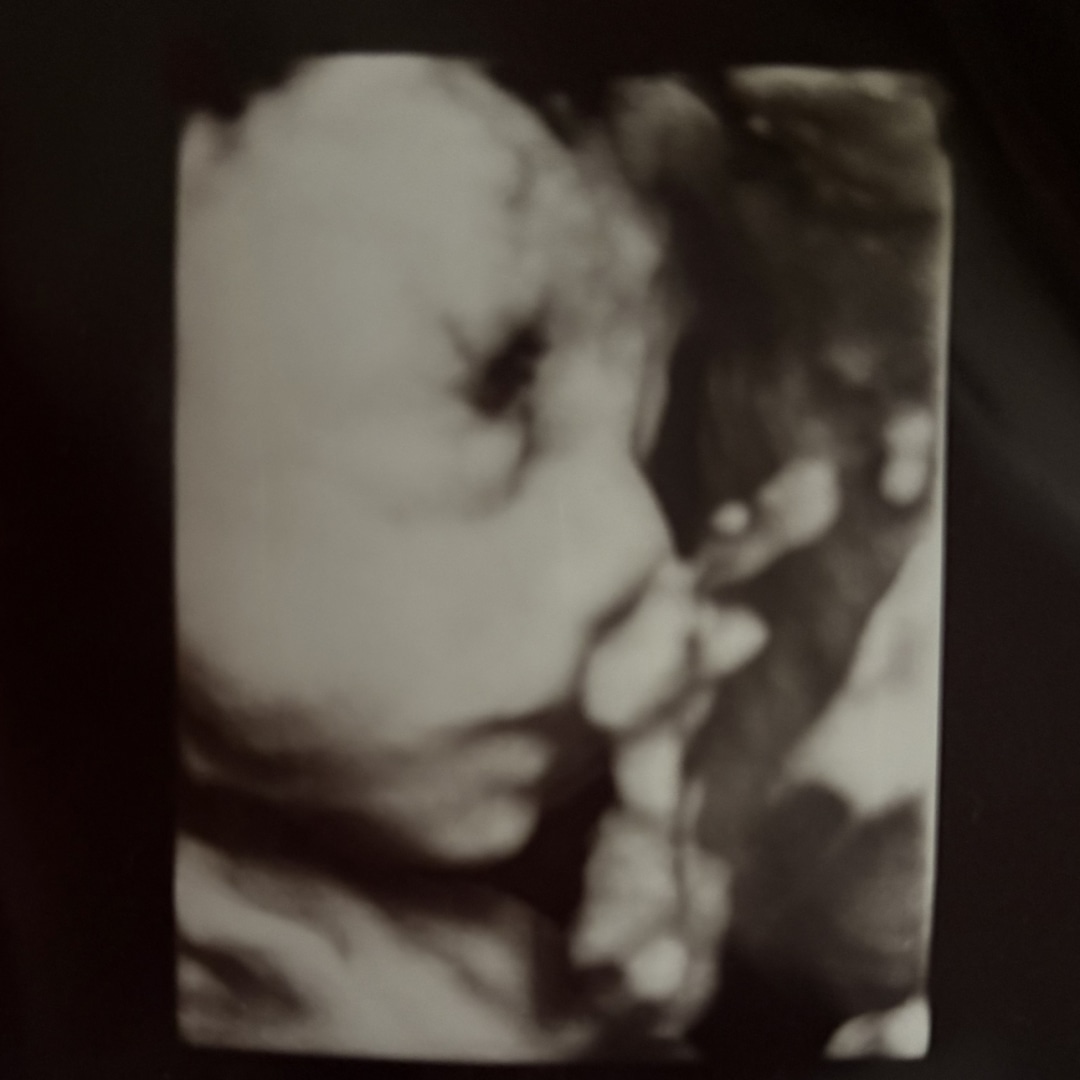 Photo shared by Adelmi for their Babylist baby registry.