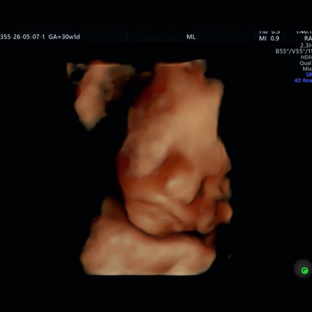 Photo shared by Jennifer for their Babylist baby registry.