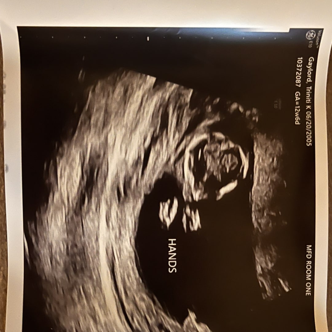 Photo shared by Triniti for their Babylist baby registry.