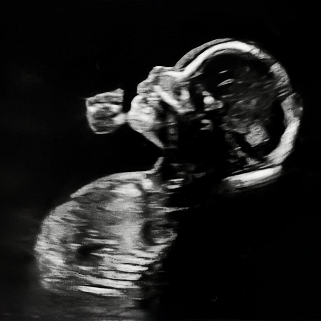 Photo shared by Giselle for their Babylist baby registry.