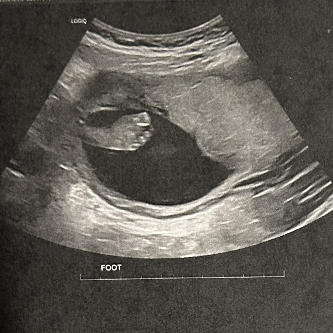 Photo shared by Brylea for their Babylist baby registry.