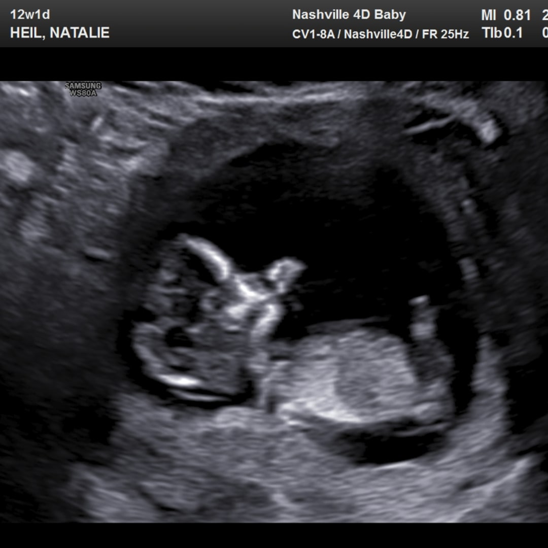 Photo shared by Natalie for their Babylist baby registry.