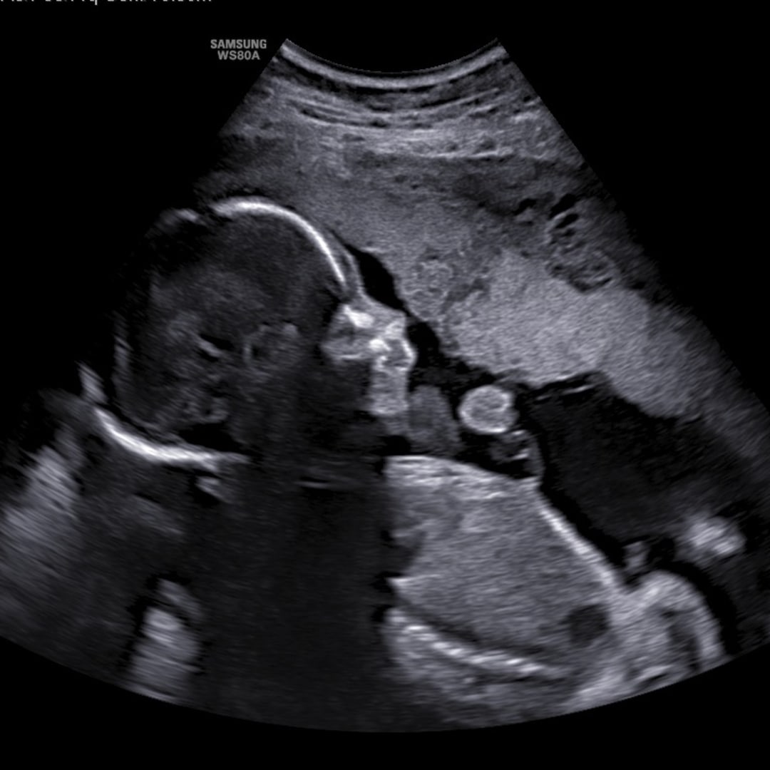 Photo shared by Jessica & Ceasar for their Babylist baby registry.