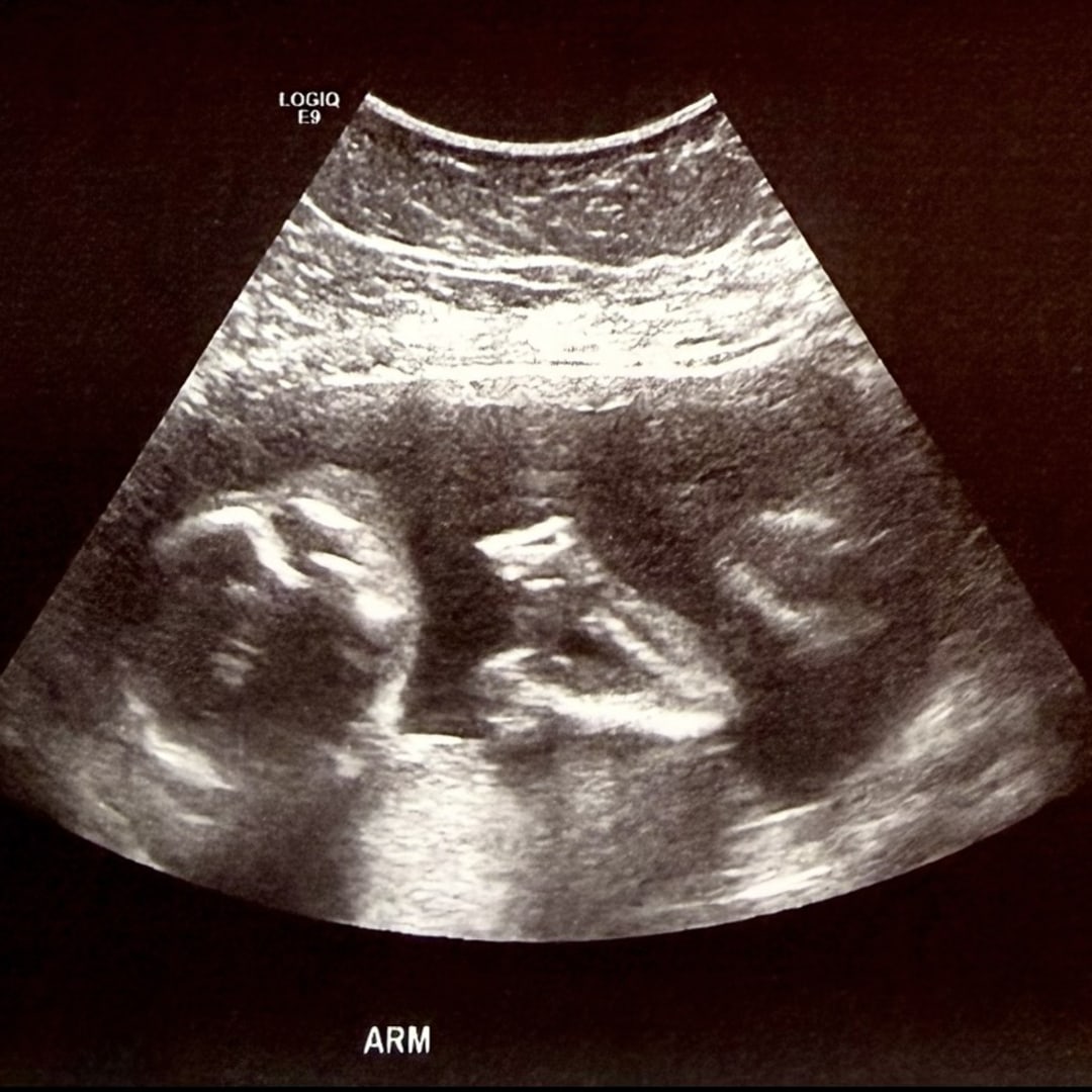 Photo shared by Kristi for their Babylist baby registry.