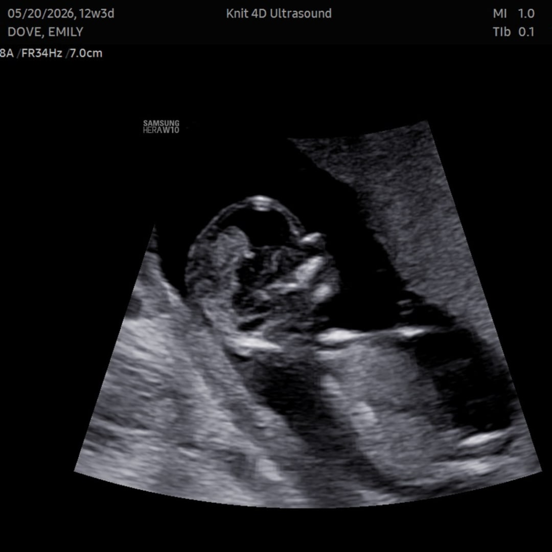 Photo shared by Emily for their Babylist baby registry.