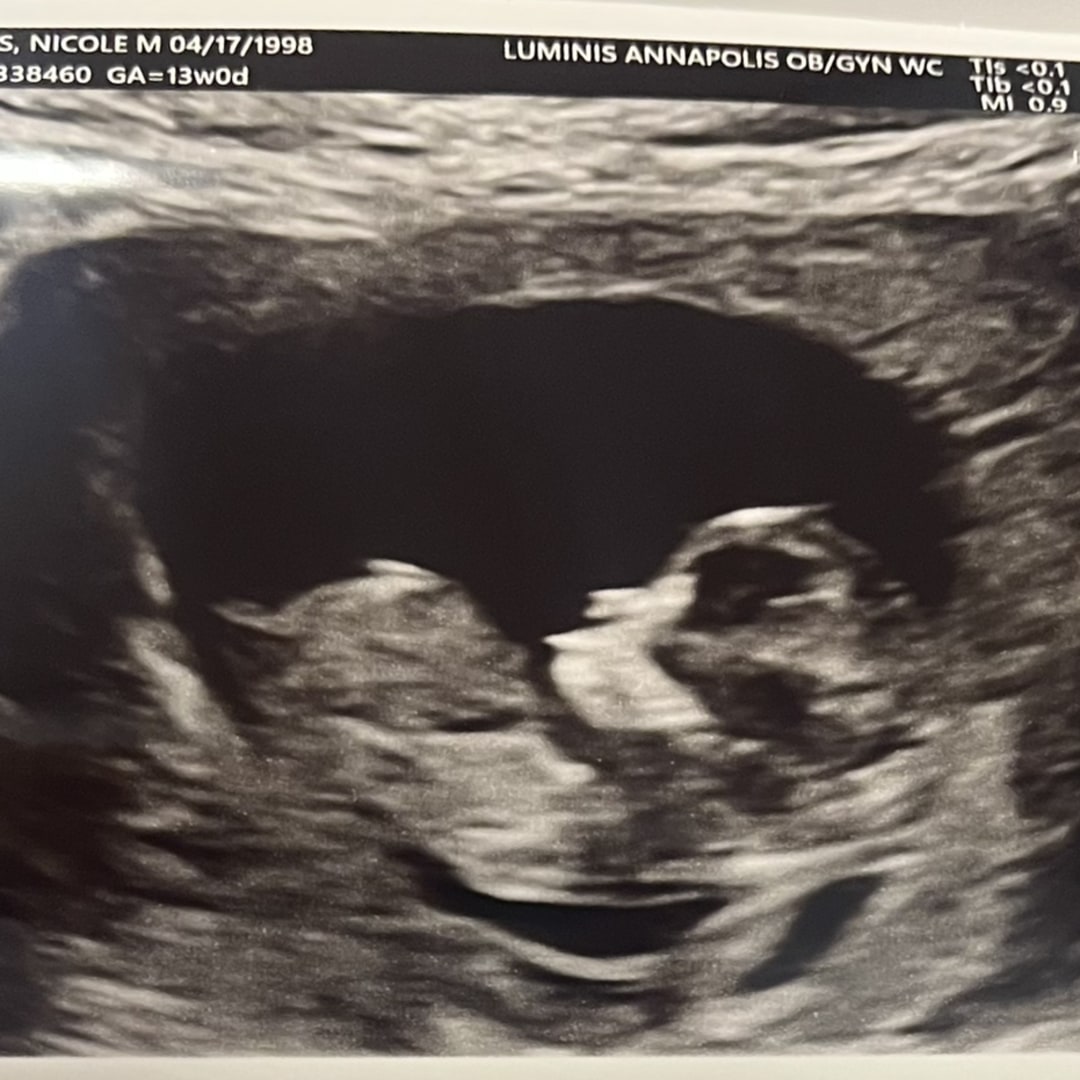 Photo shared by Nicole for their Babylist baby registry.