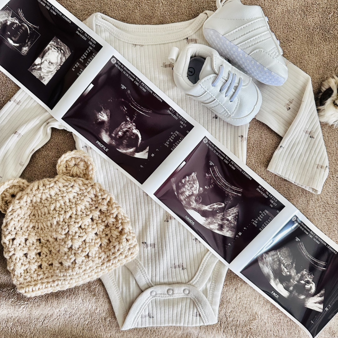 Photo shared by Leandra for their Babylist baby registry.