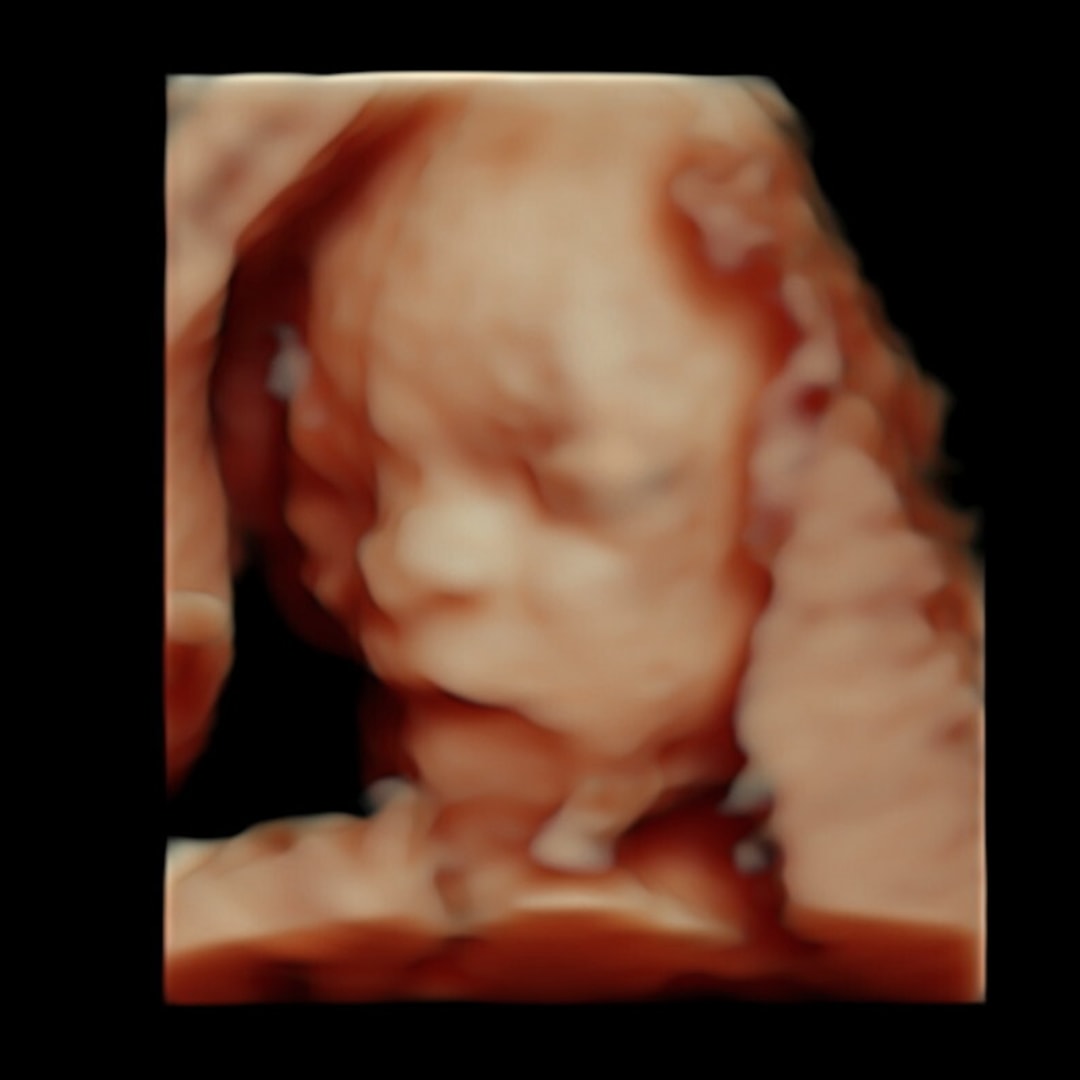 Photo shared by Paris Elizabeth for their Babylist baby registry.