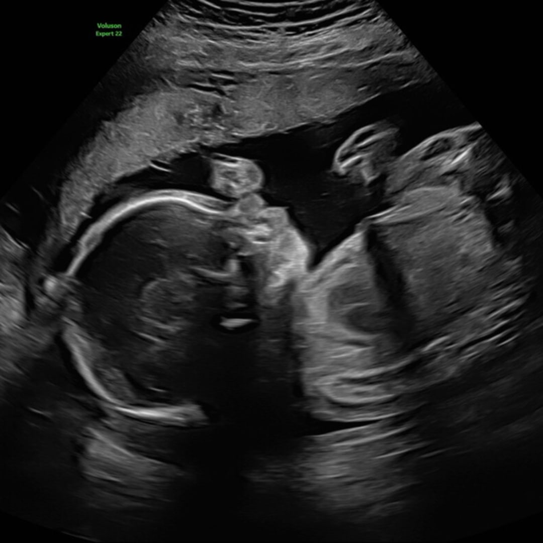 Photo shared by Alexis for their Babylist baby registry.