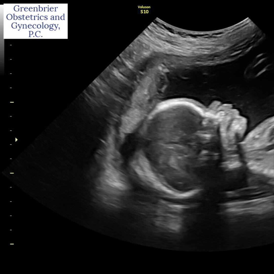 Photo shared by Amelia for their Babylist baby registry.
