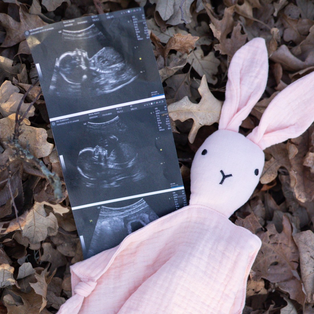 Photo shared by Alyssa for their Babylist baby registry.