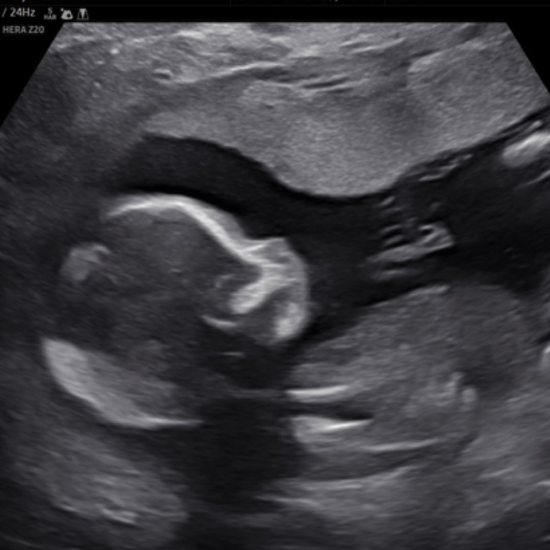 Photo shared by Megan for their Babylist baby registry.