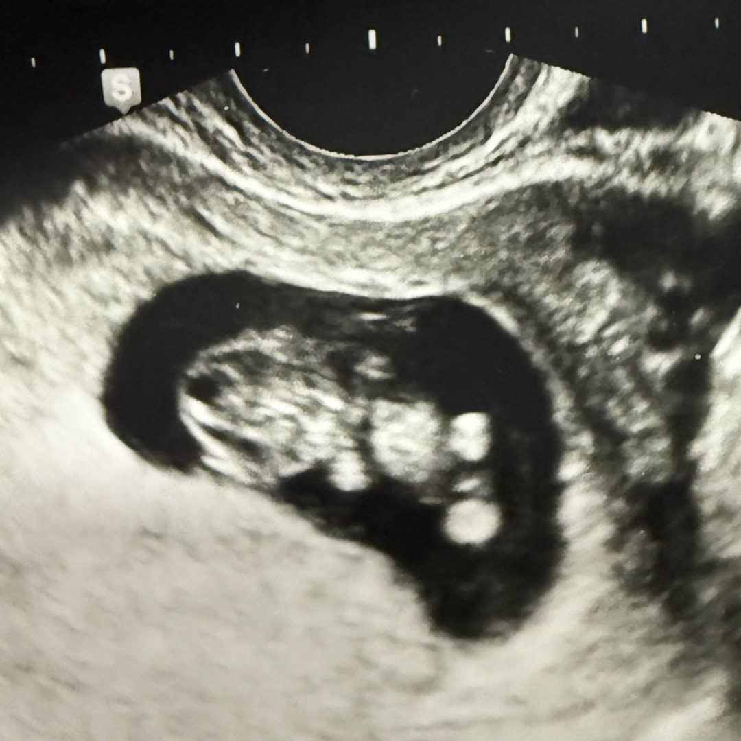 Photo shared by Julia for their Babylist baby registry.