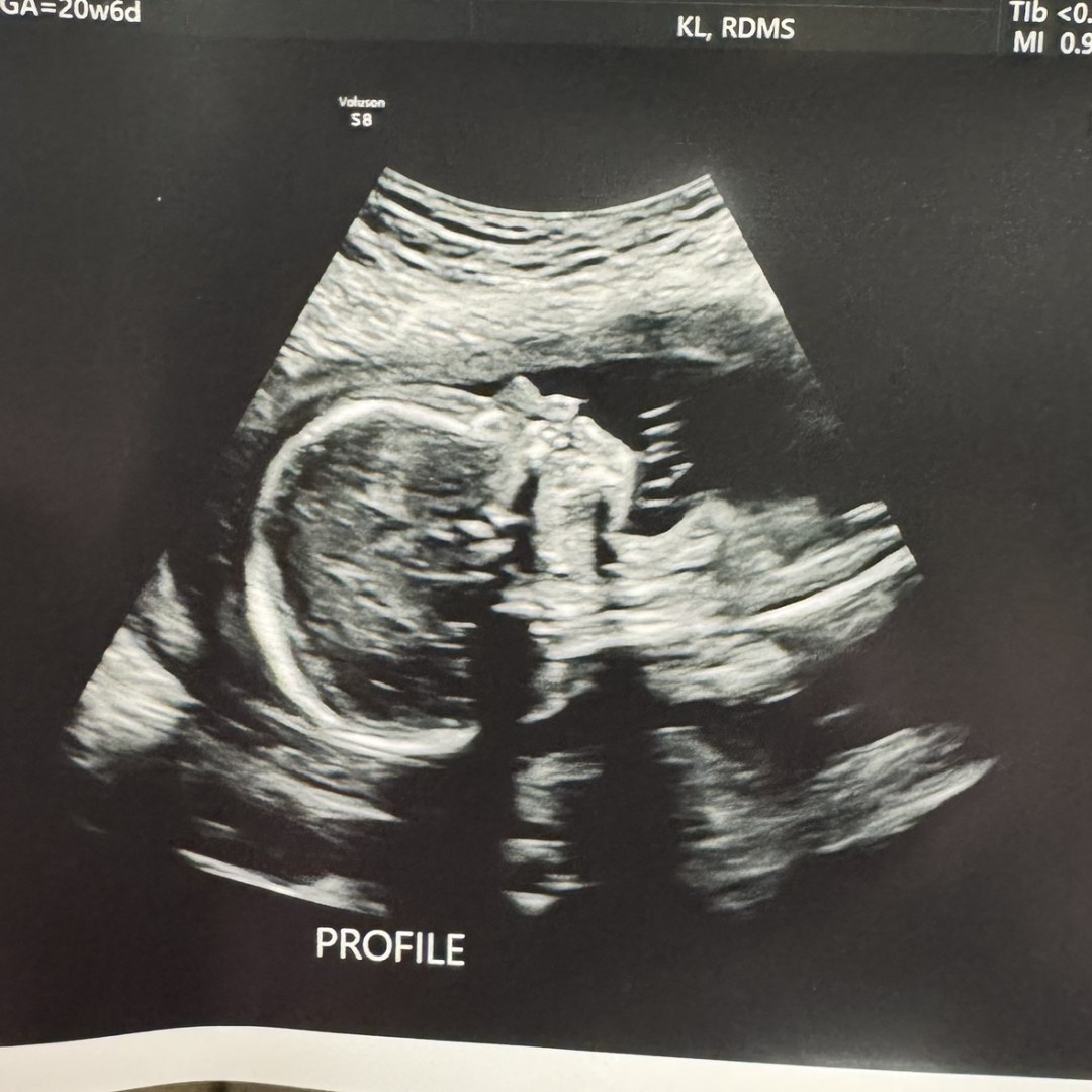 Photo shared by Charlotte for their Babylist baby registry.