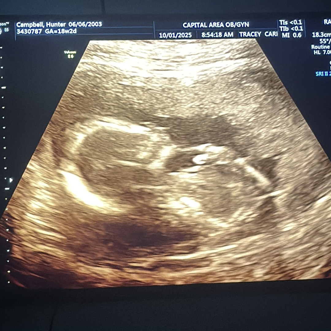 Photo shared by Hunter for their Babylist baby registry.