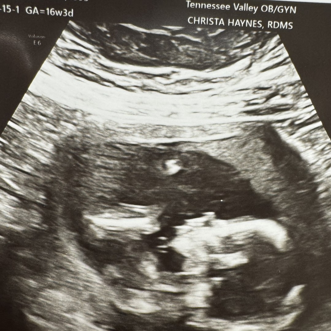 Photo shared by Stephania for their Babylist baby registry.