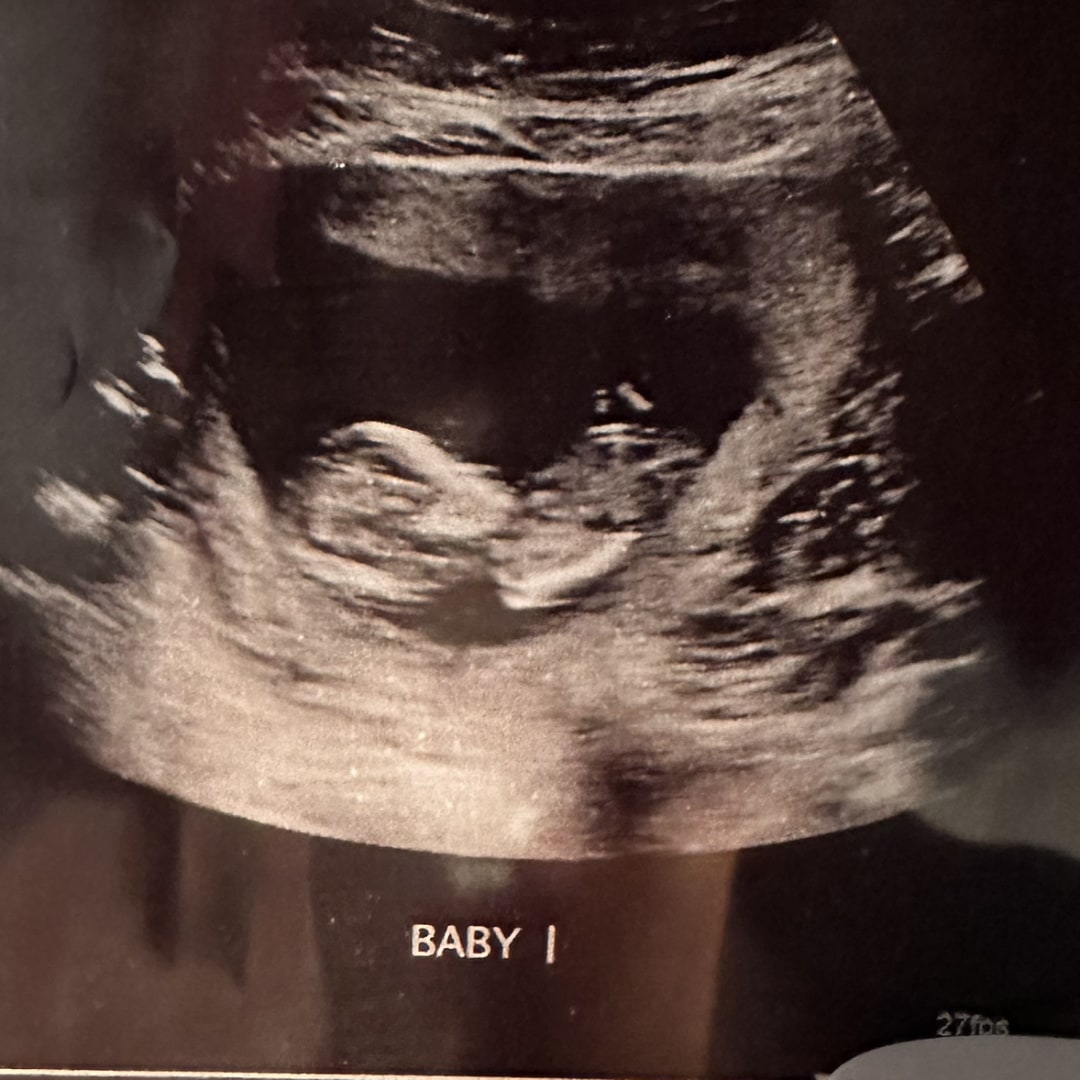 Photo shared by Vanessa for their Babylist baby registry.