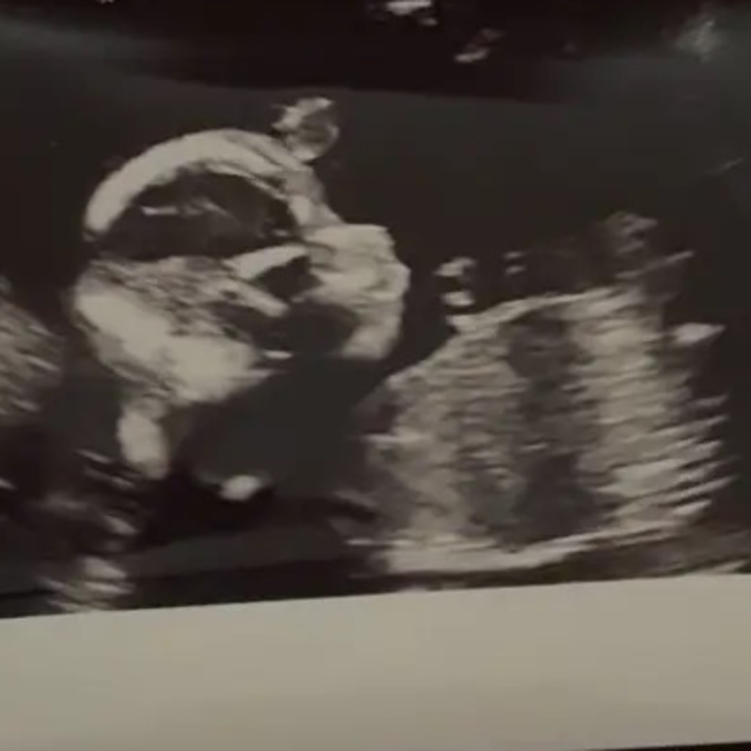 Photo shared by Audrey for their Babylist baby registry.
