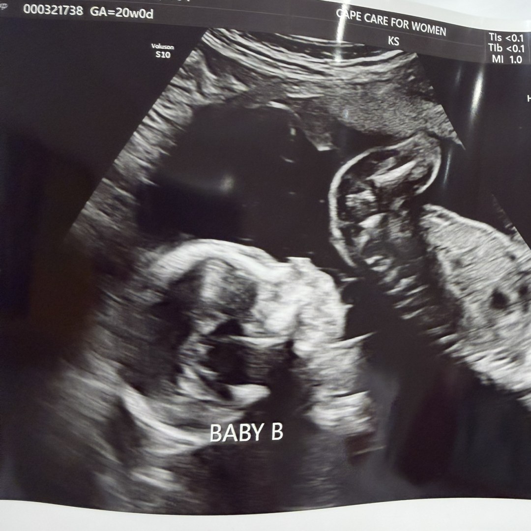 Photo shared by Haley for their Babylist baby registry.