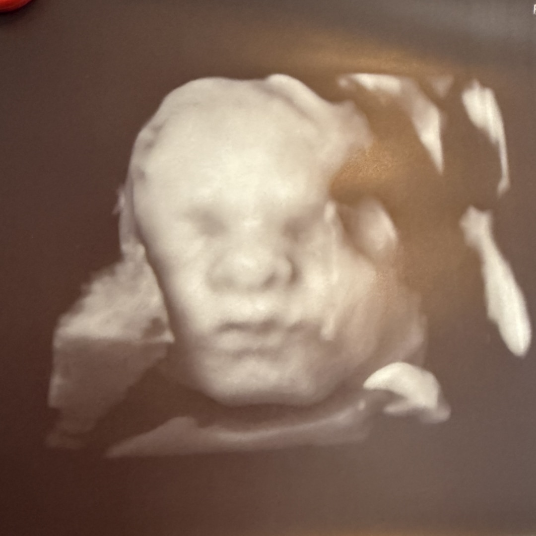 Photo shared by Chelsea for their Babylist baby registry.