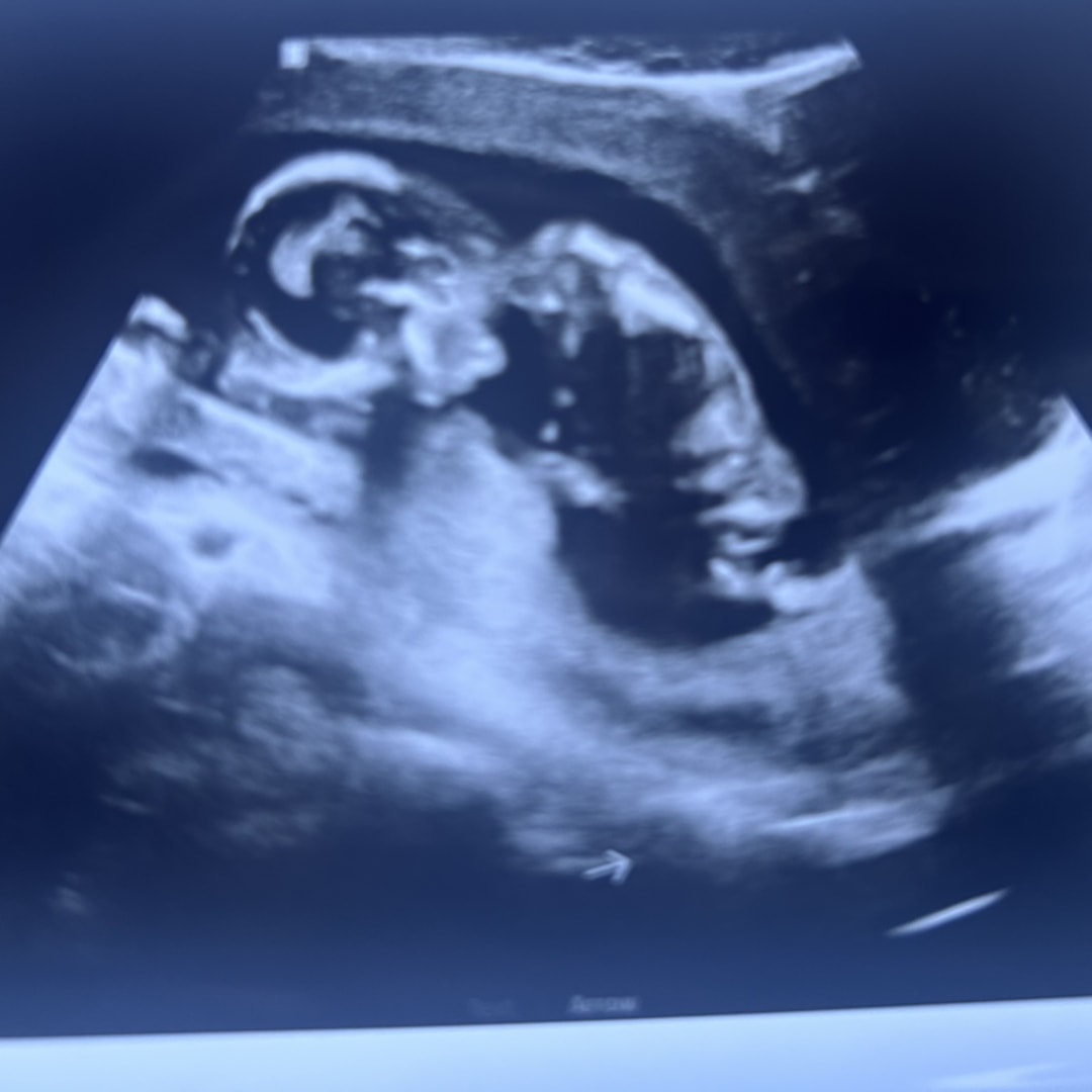 Photo shared by Elisha for their Babylist baby registry.