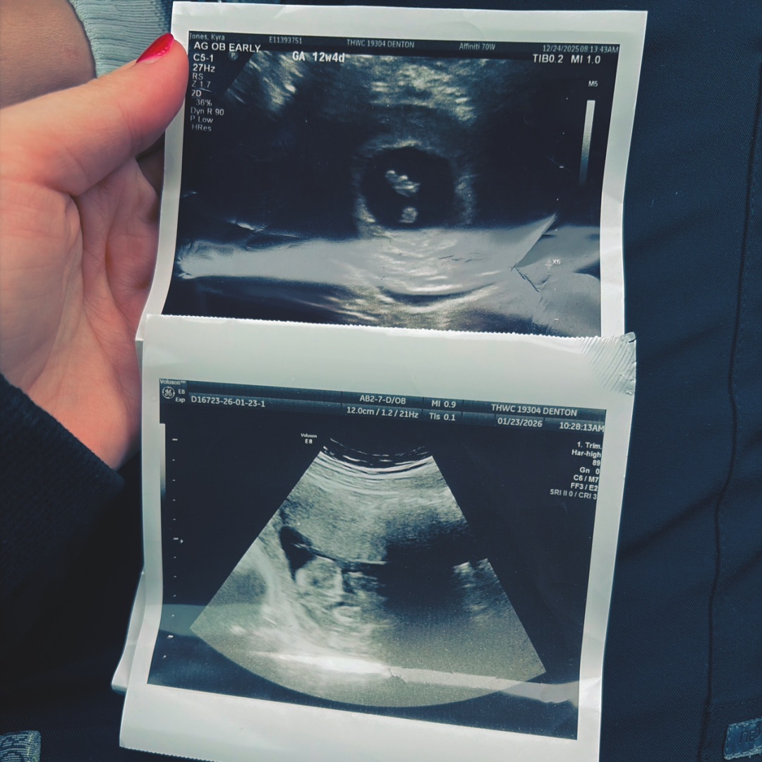 Photo shared by Kyra for their Babylist baby registry.
