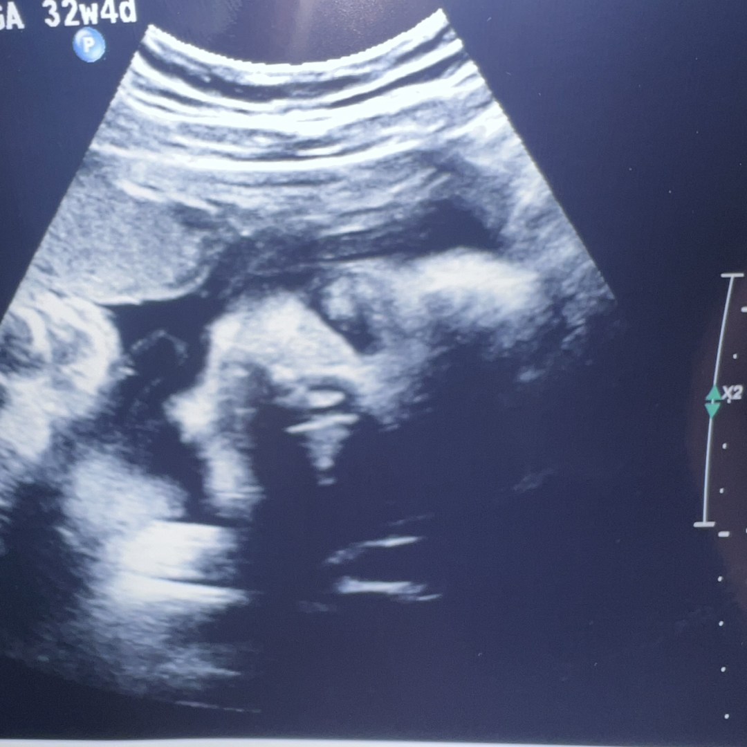 Photo shared by Kailey for their Babylist baby registry.