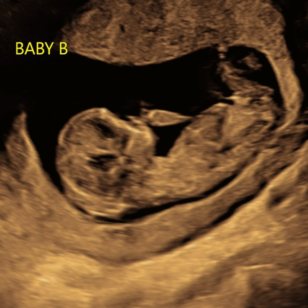 Photo shared by Sarah for their Babylist baby registry.