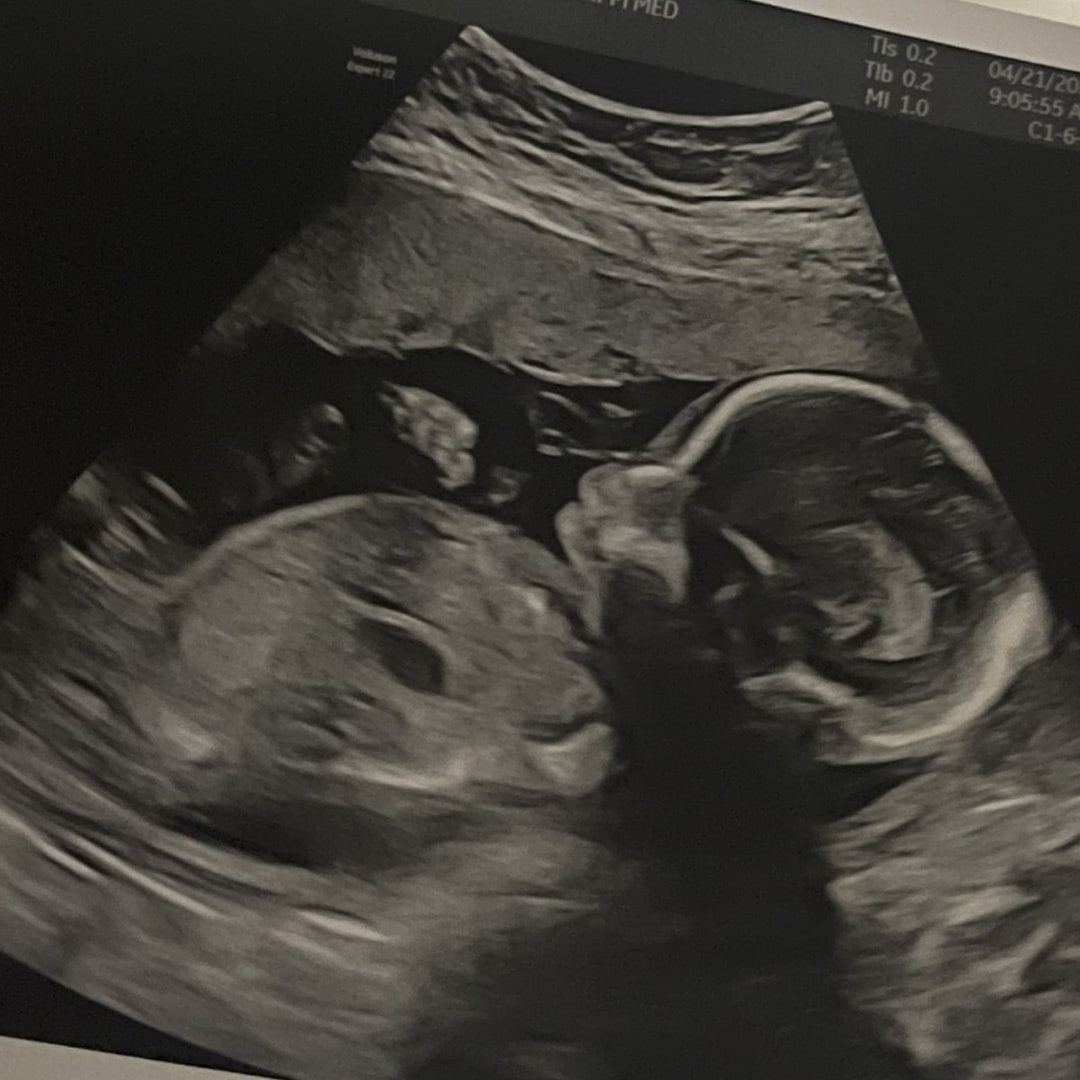 Photo shared by JoLee for their Babylist baby registry.