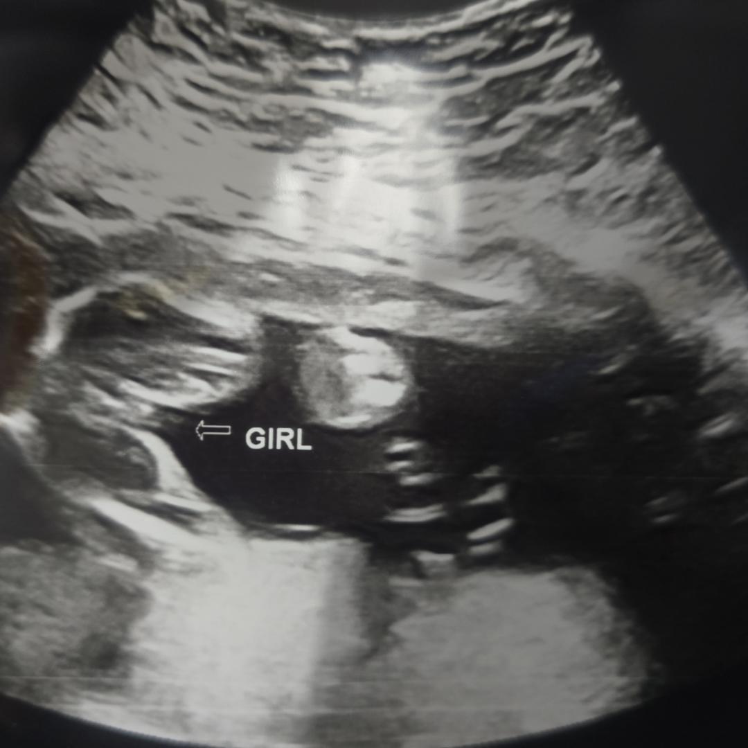 Photo shared by Chayanne for their Babylist baby registry.