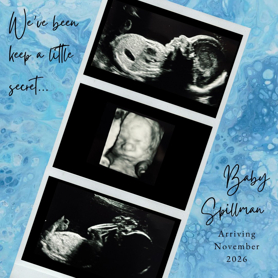 Photo shared by McKenzie for their Babylist baby registry.