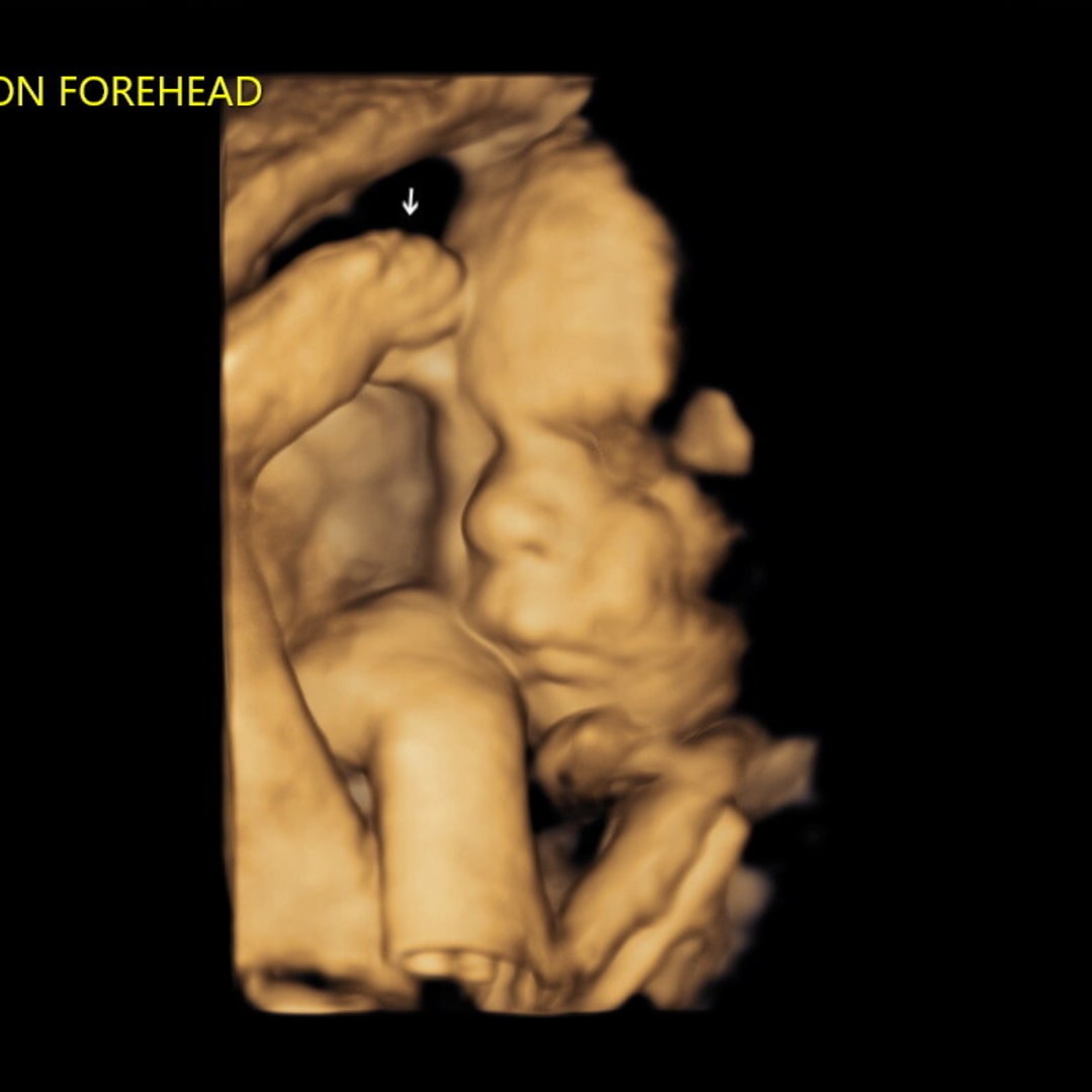 Photo shared by Kalynn for their Babylist baby registry.