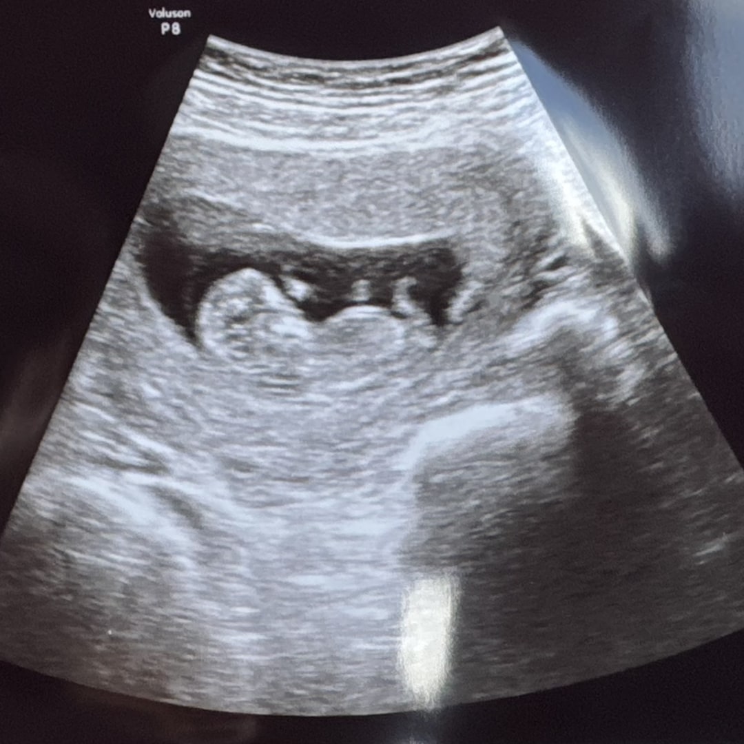 Photo shared by Hewan for their Babylist baby registry.