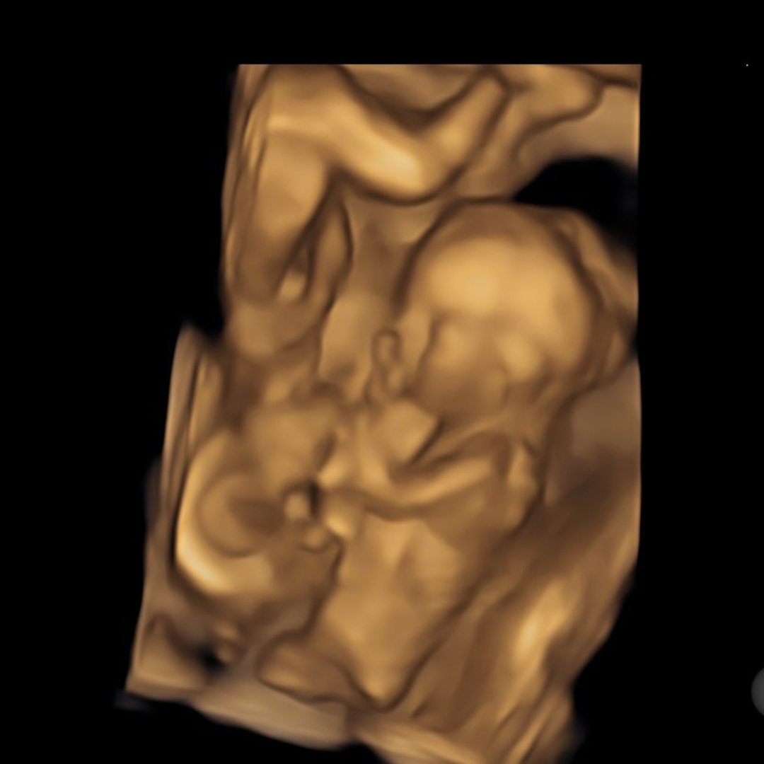 Photo shared by Makayla for their Babylist baby registry.