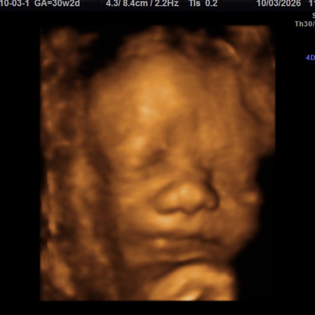 Photo shared by Nic for their Babylist baby registry.