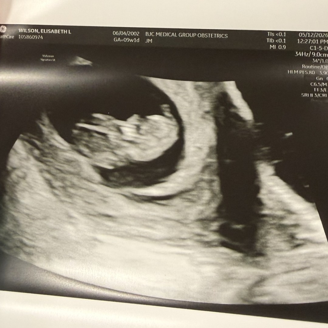 Photo shared by Elisabeth for their Babylist baby registry.