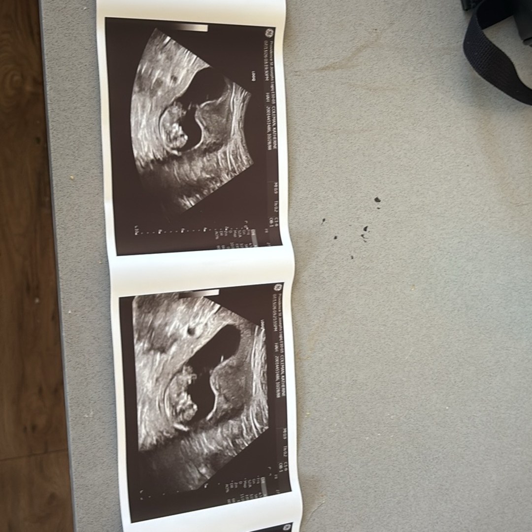 Photo shared by Katie for their Babylist baby registry.