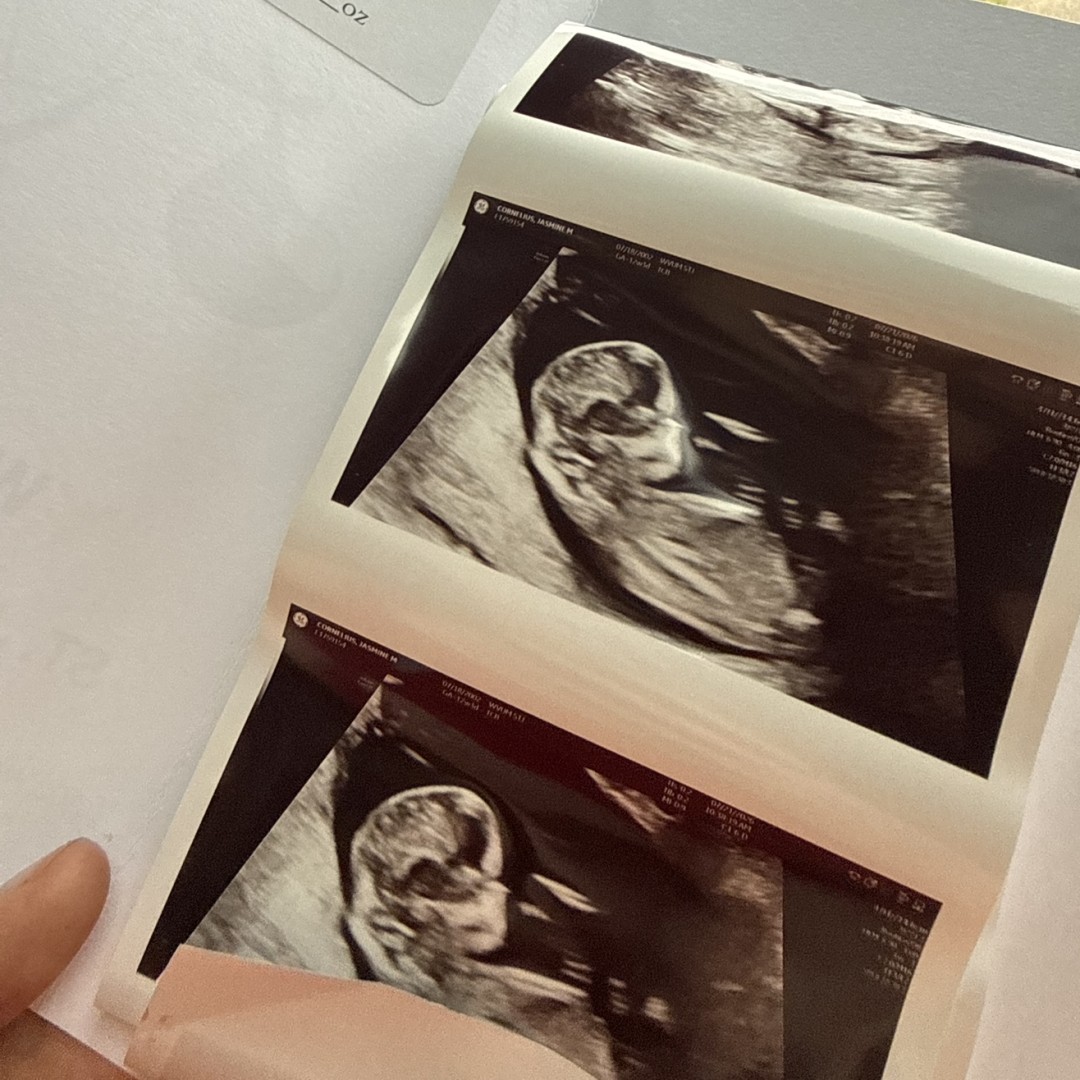 Photo shared by Jasmine for their Babylist baby registry.