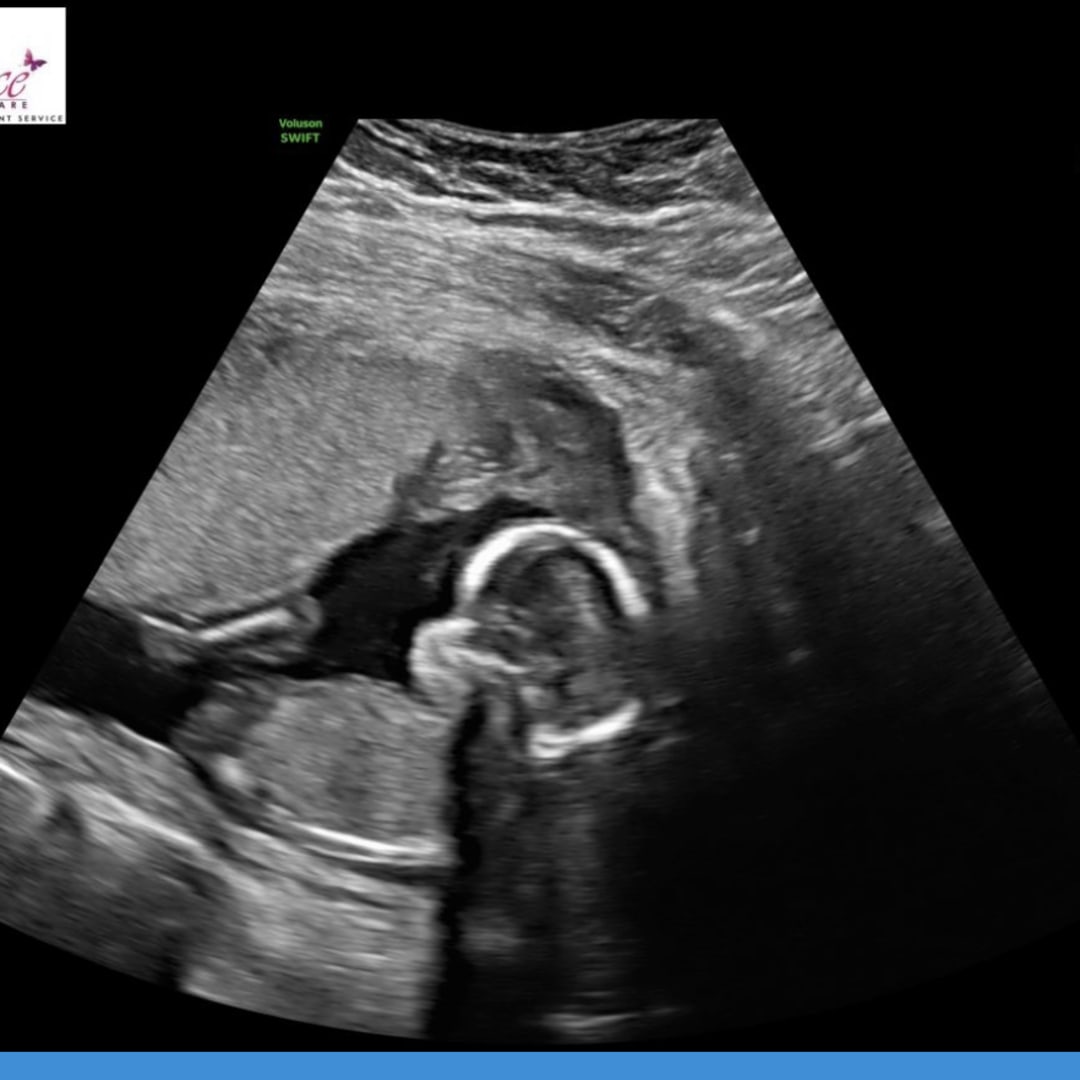 Photo shared by Ashley for their Babylist baby registry.
