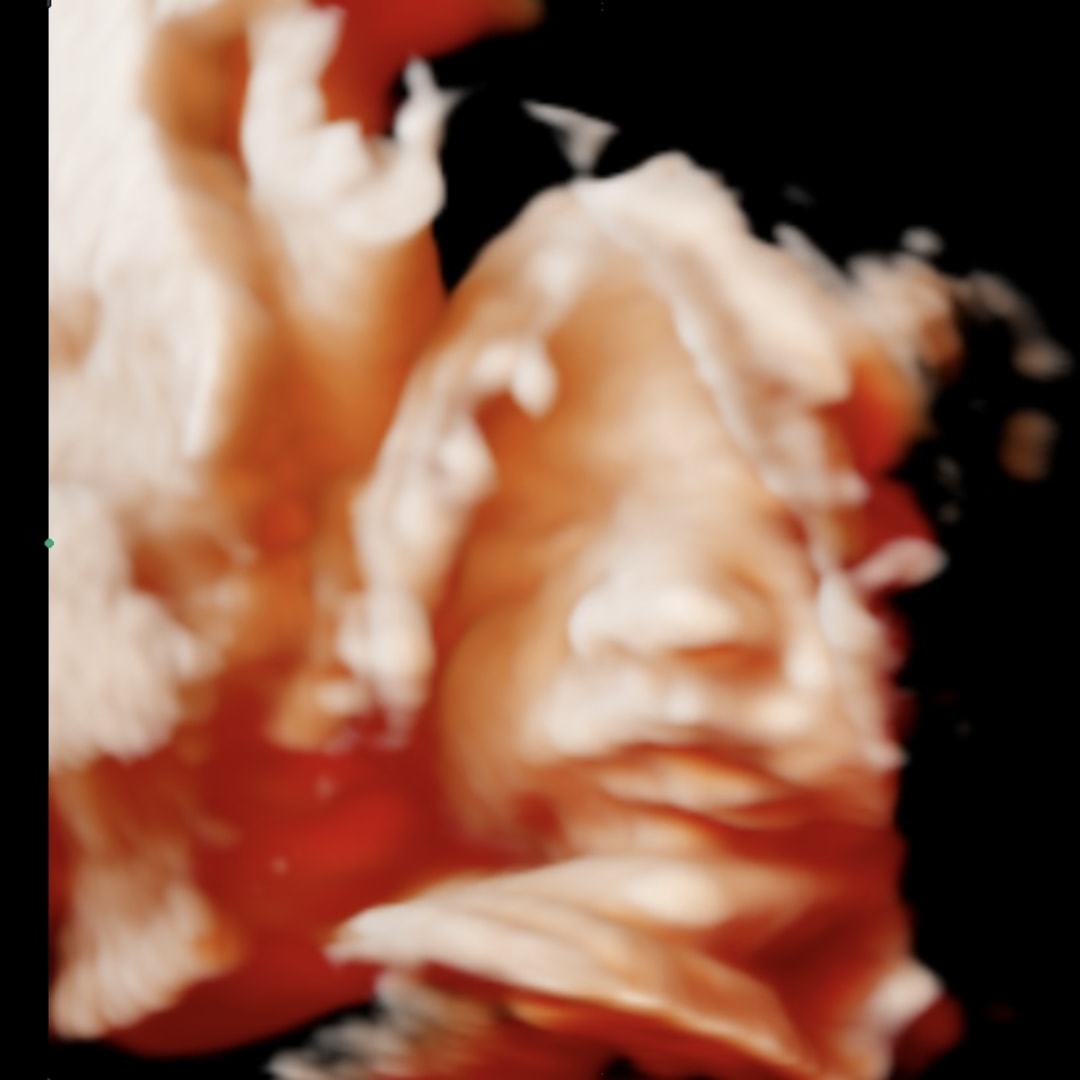 Photo shared by Athziri for their Babylist baby registry.