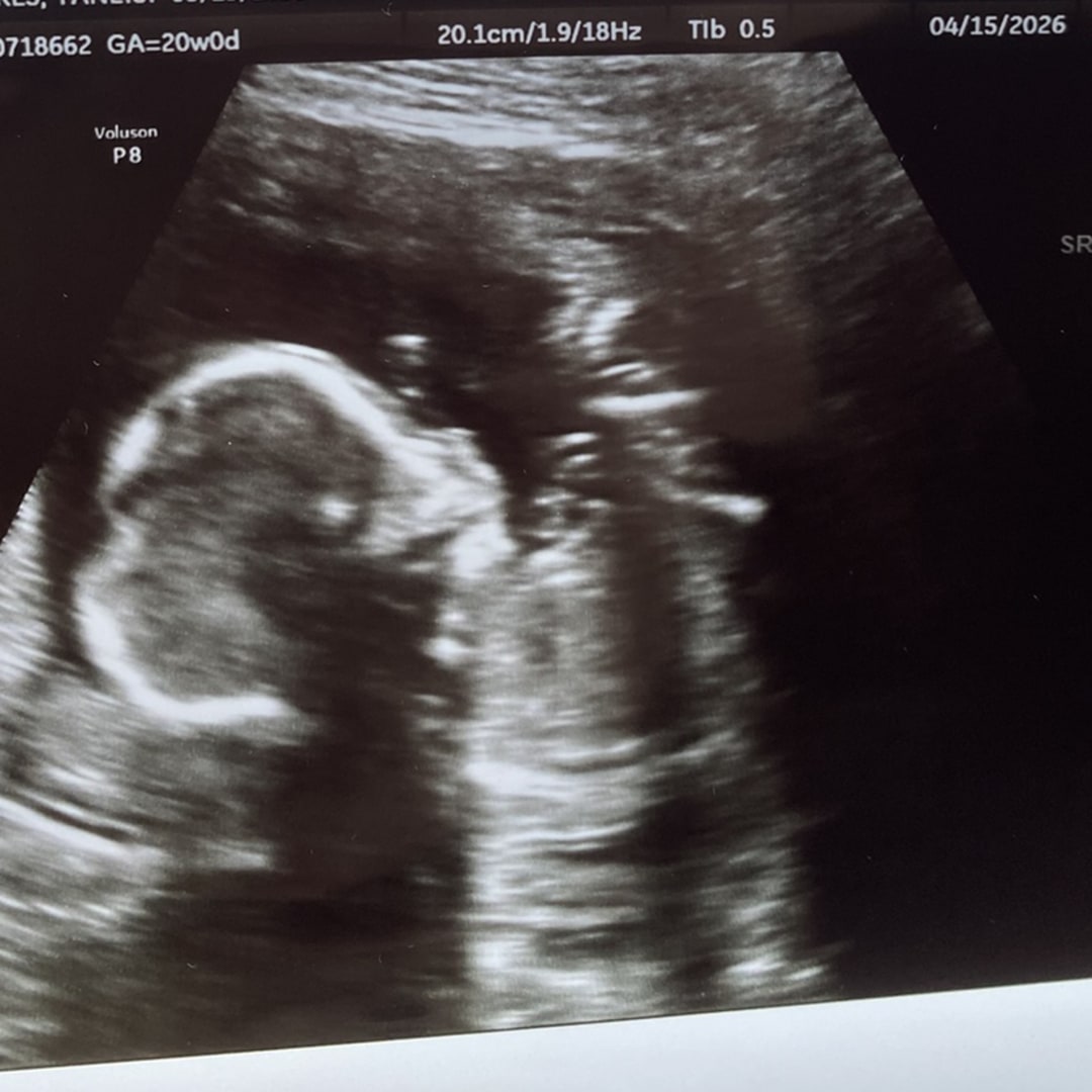 Photo shared by Yaneisi for their Babylist baby registry.