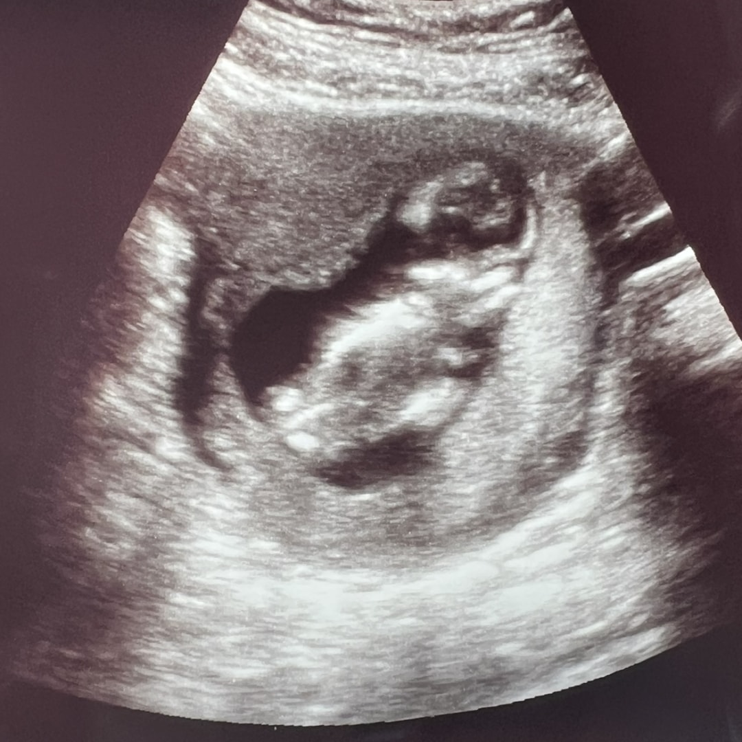 Photo shared by Nikki for their Babylist baby registry.