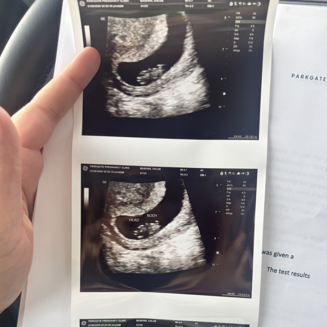 Photo shared by Chloe for their Babylist baby registry.