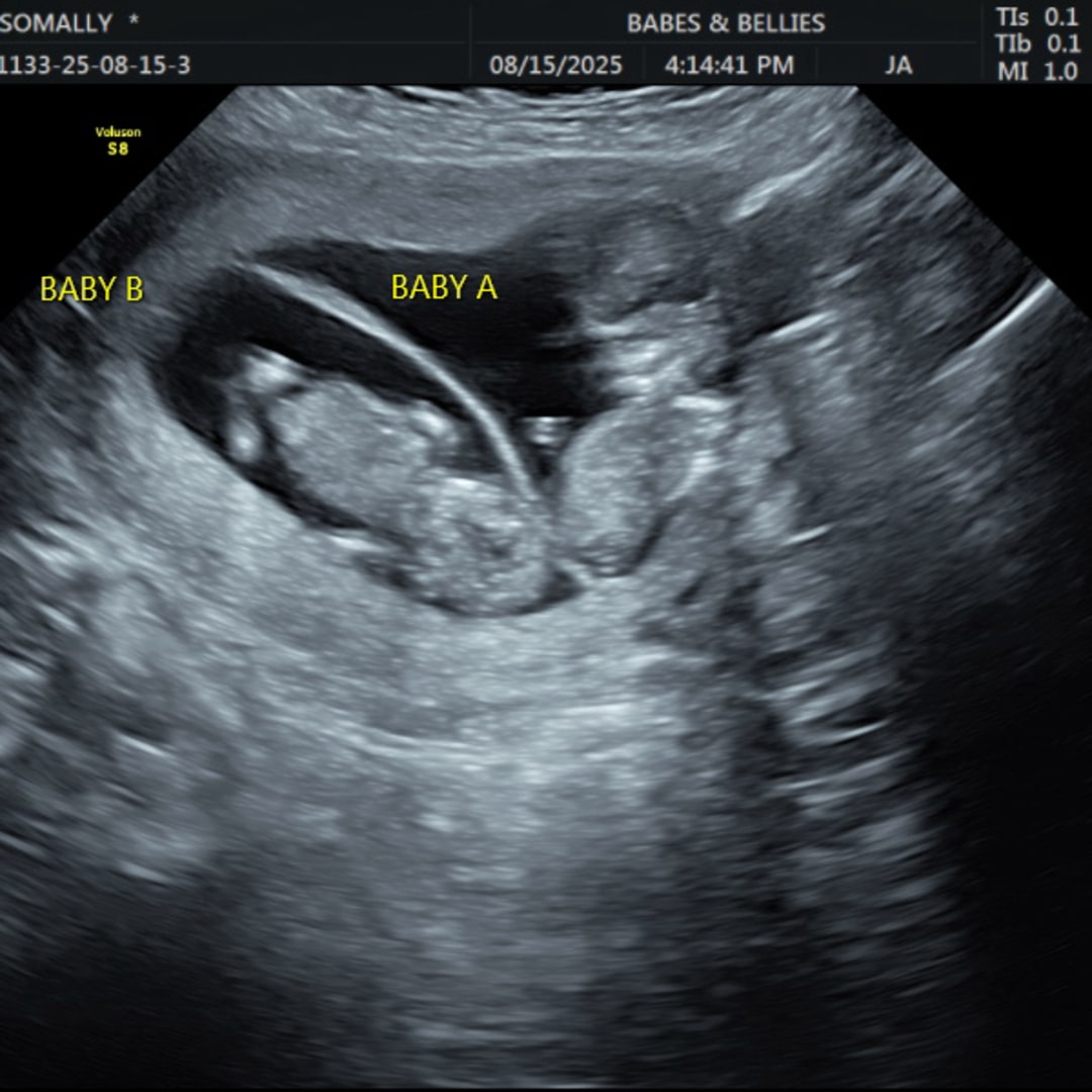 Photo shared by Molly for their Babylist baby registry.