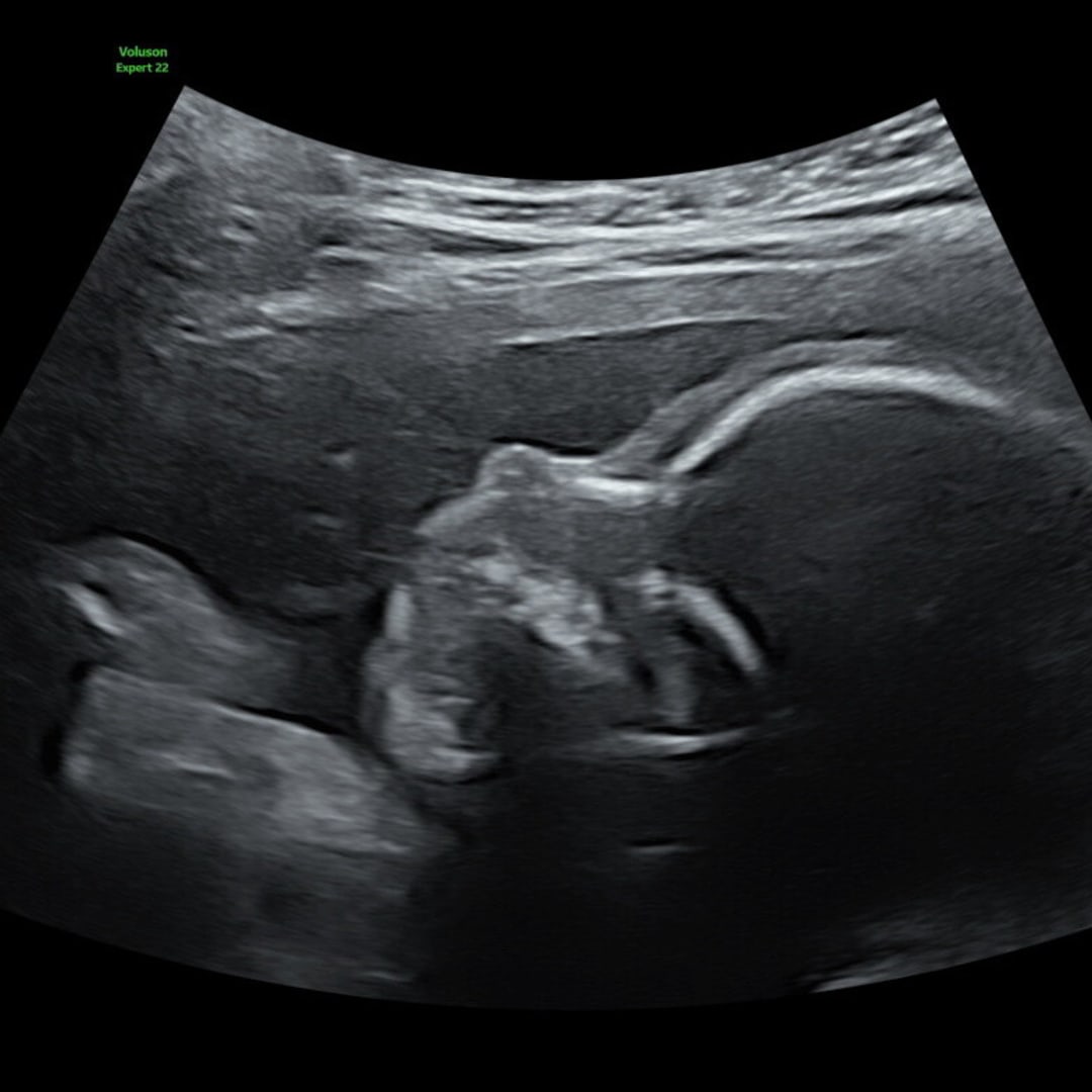 Photo shared by Harlie for their Babylist baby registry.