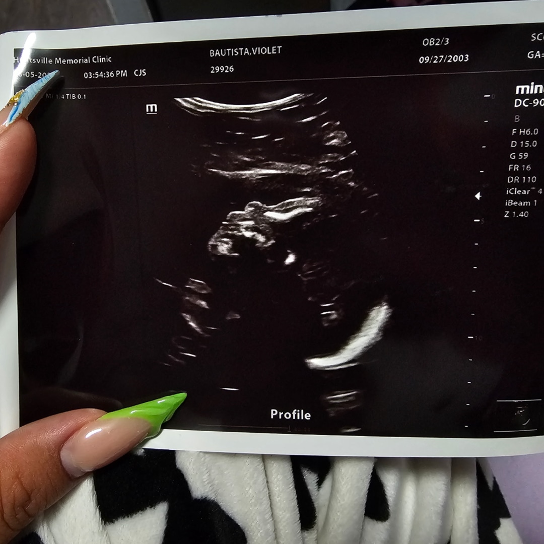 Photo shared by Violet for their Babylist baby registry.