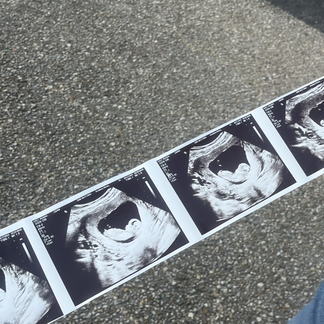 Photo shared by Reagan for their Babylist baby registry.