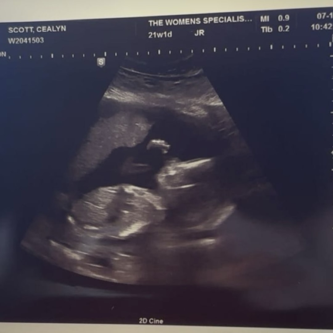 Photo shared by Caelyn for their Babylist baby registry.