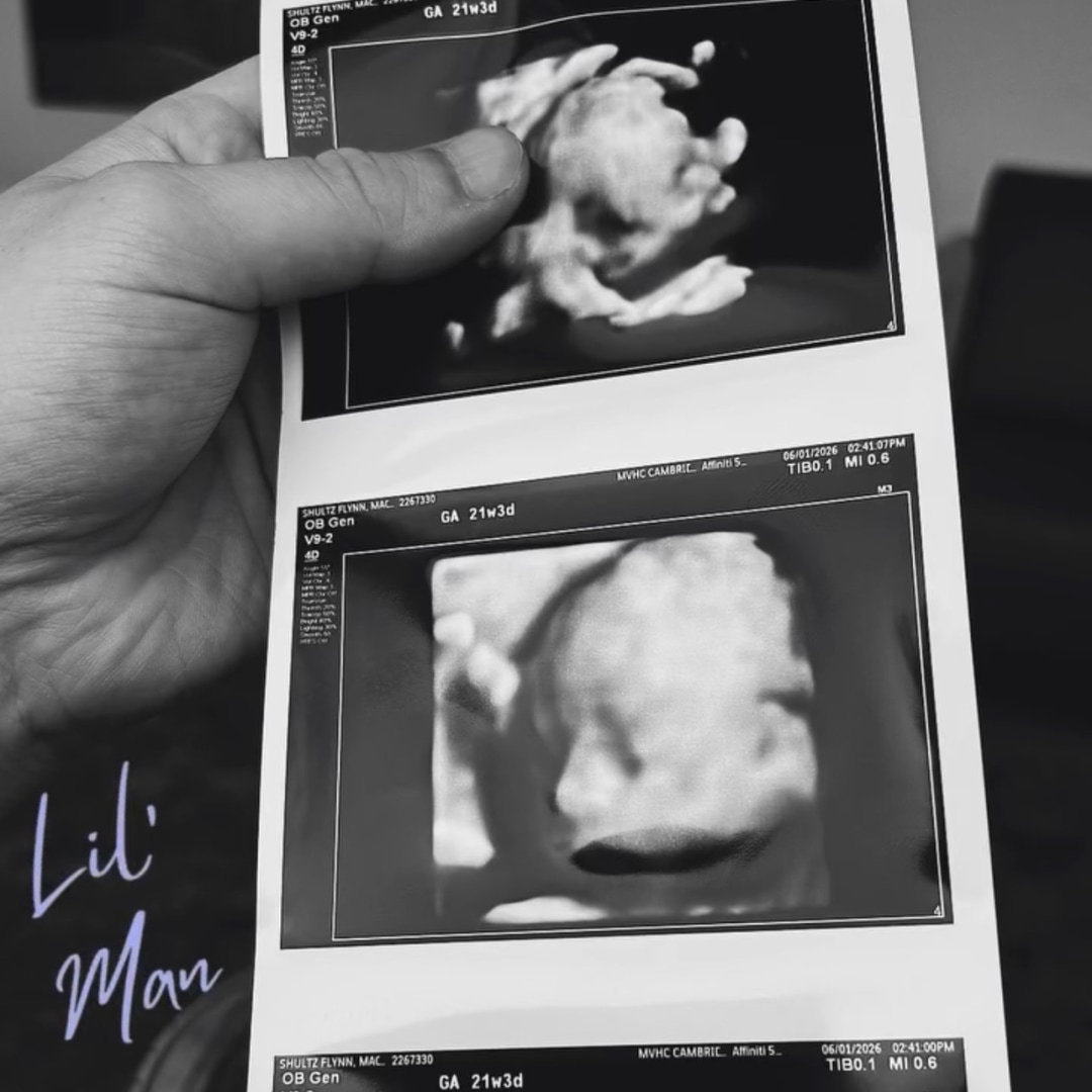 Photo shared by Mackenzie for their Babylist baby registry.